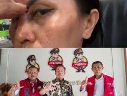 Resty Aesthetic Clinic Diduga Lakukan Malpraktik, LBH LIRA Sulsel Segera Laporkan ke Polda SulSel